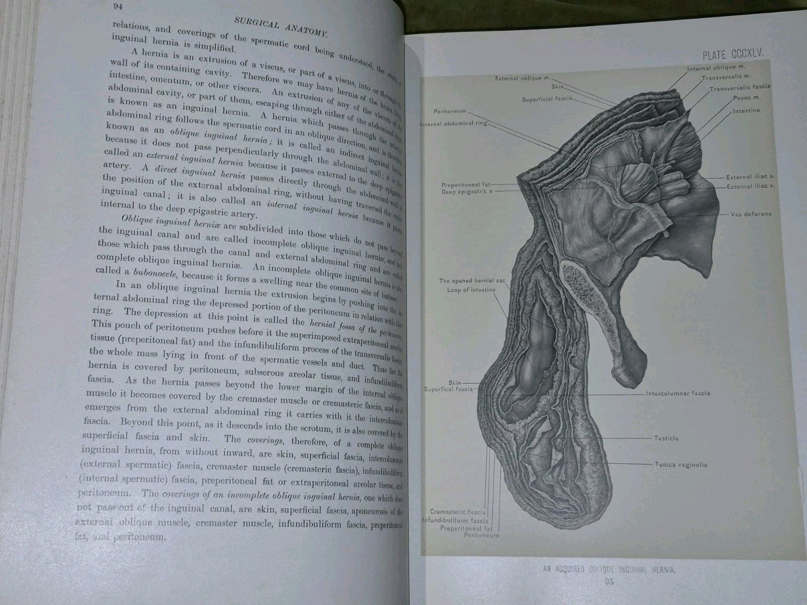 Surgical Anatomy Vols. 1 to 3, (1901-1903) John B. Deaver. London: Rebman9