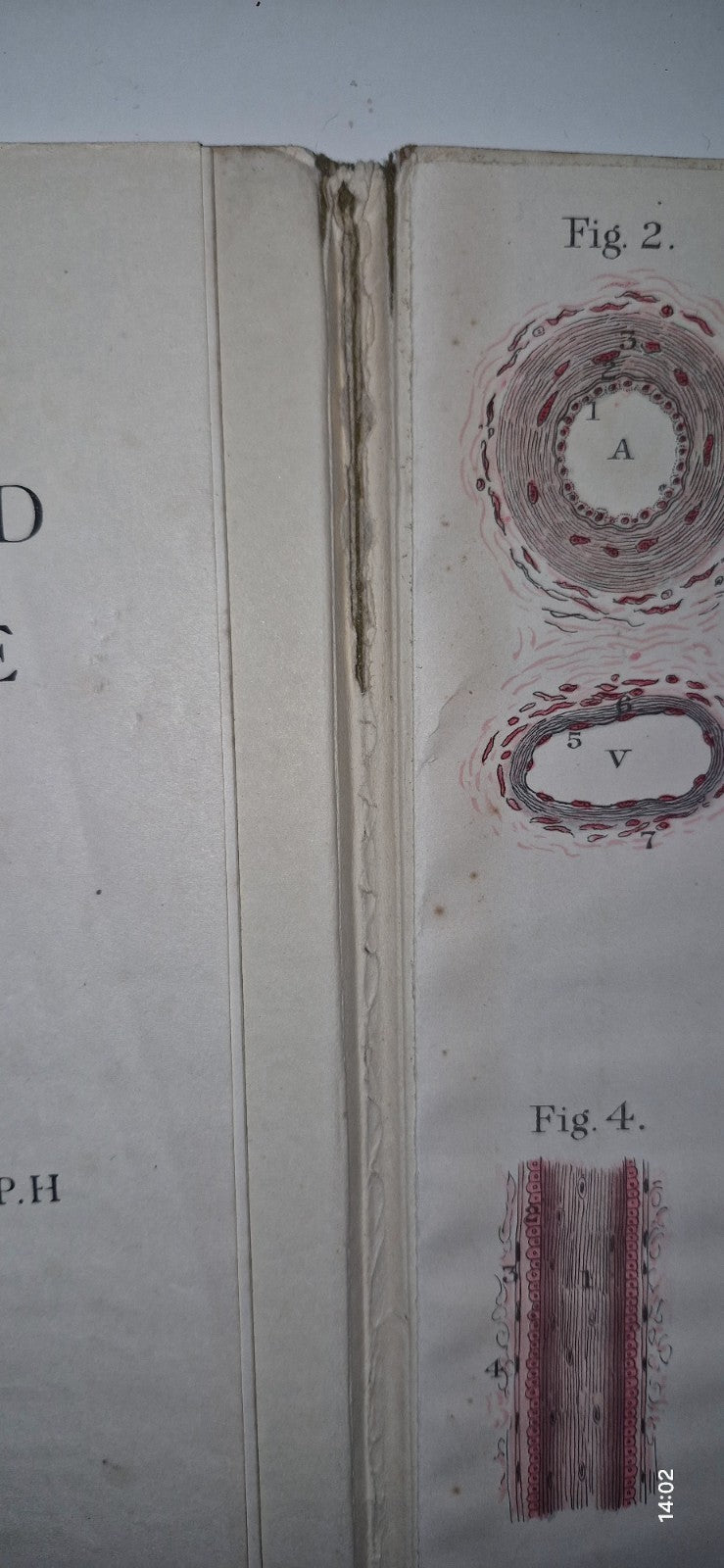 1921 Baillieres Atlas & Anatomy Of The Female Human Body. Swedish Massage Inst.5