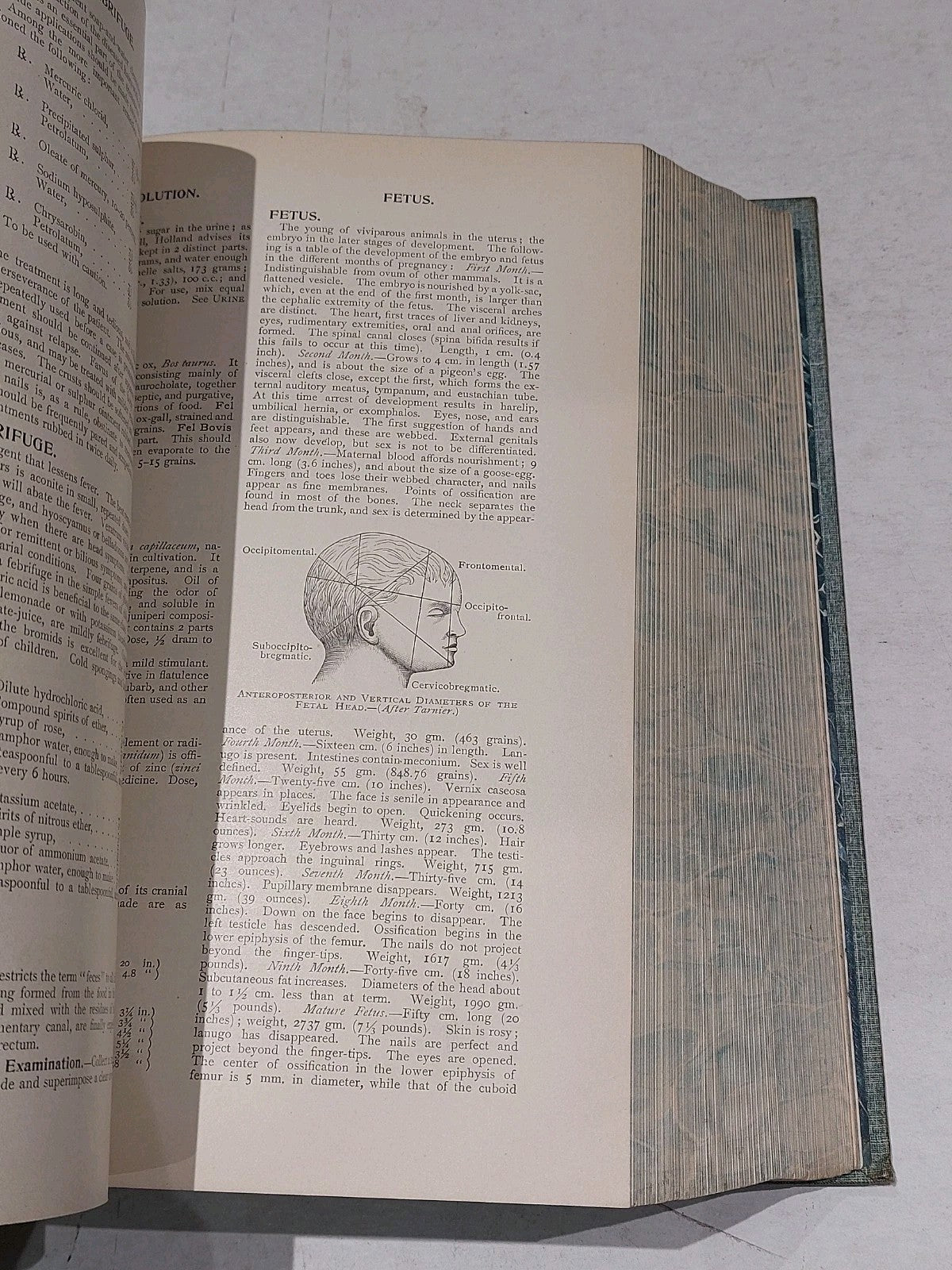 Cyclopedia Of Practical Medicine And Surgery By Gould & Walter (1901) Hb Leather10