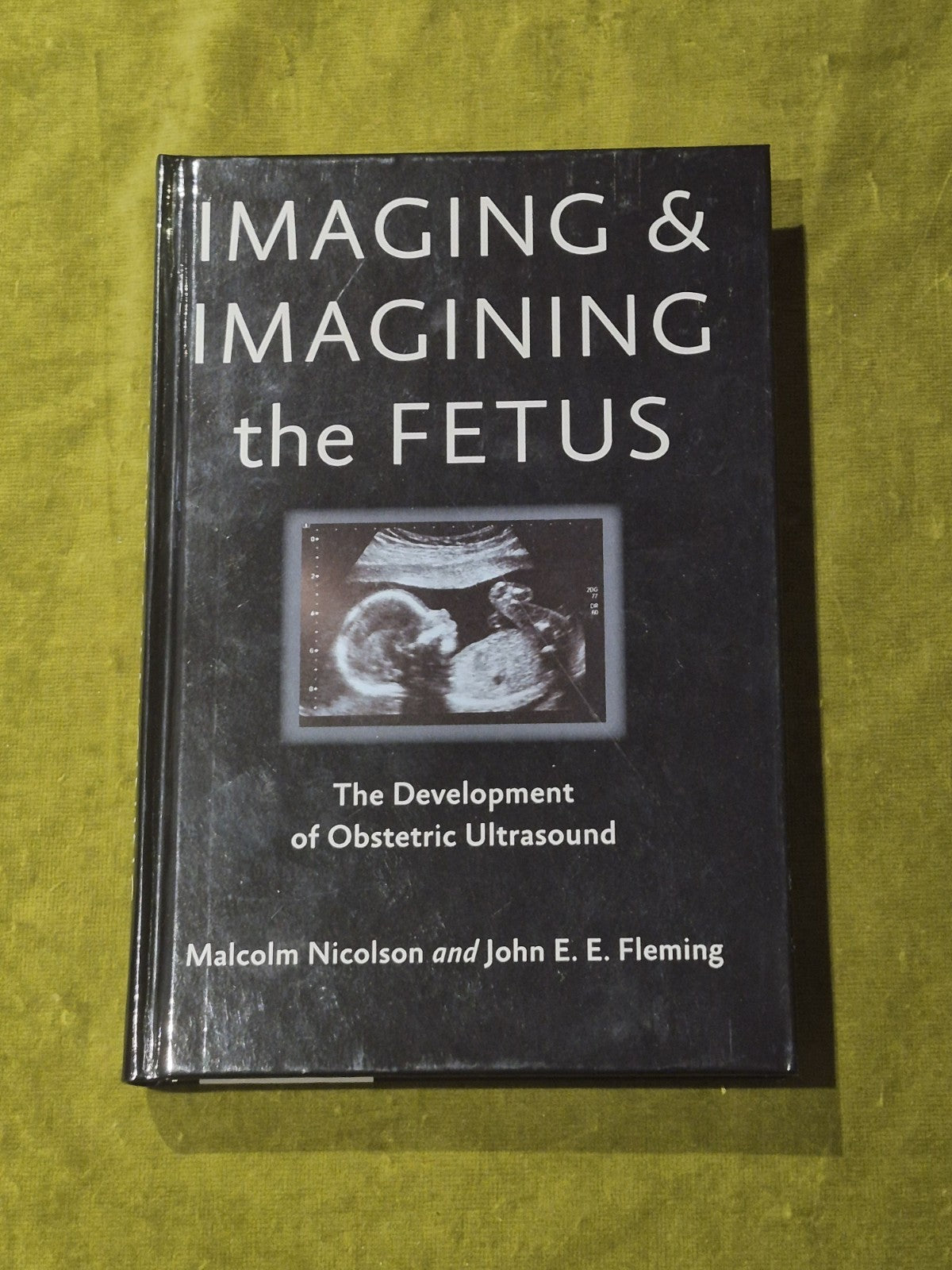 Imaging and Imagining the Fetus - HardBack Nicolson, Malco 2013 1st Ed0