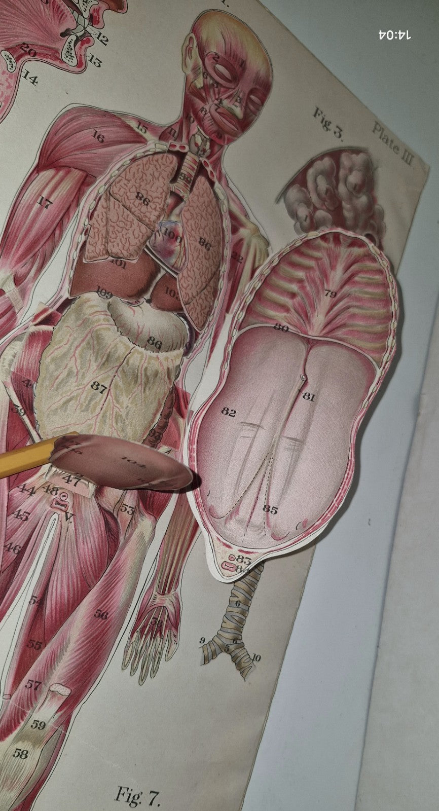 1921 Baillieres Atlas & Anatomy Of The Female Human Body. Swedish Massage Inst.12