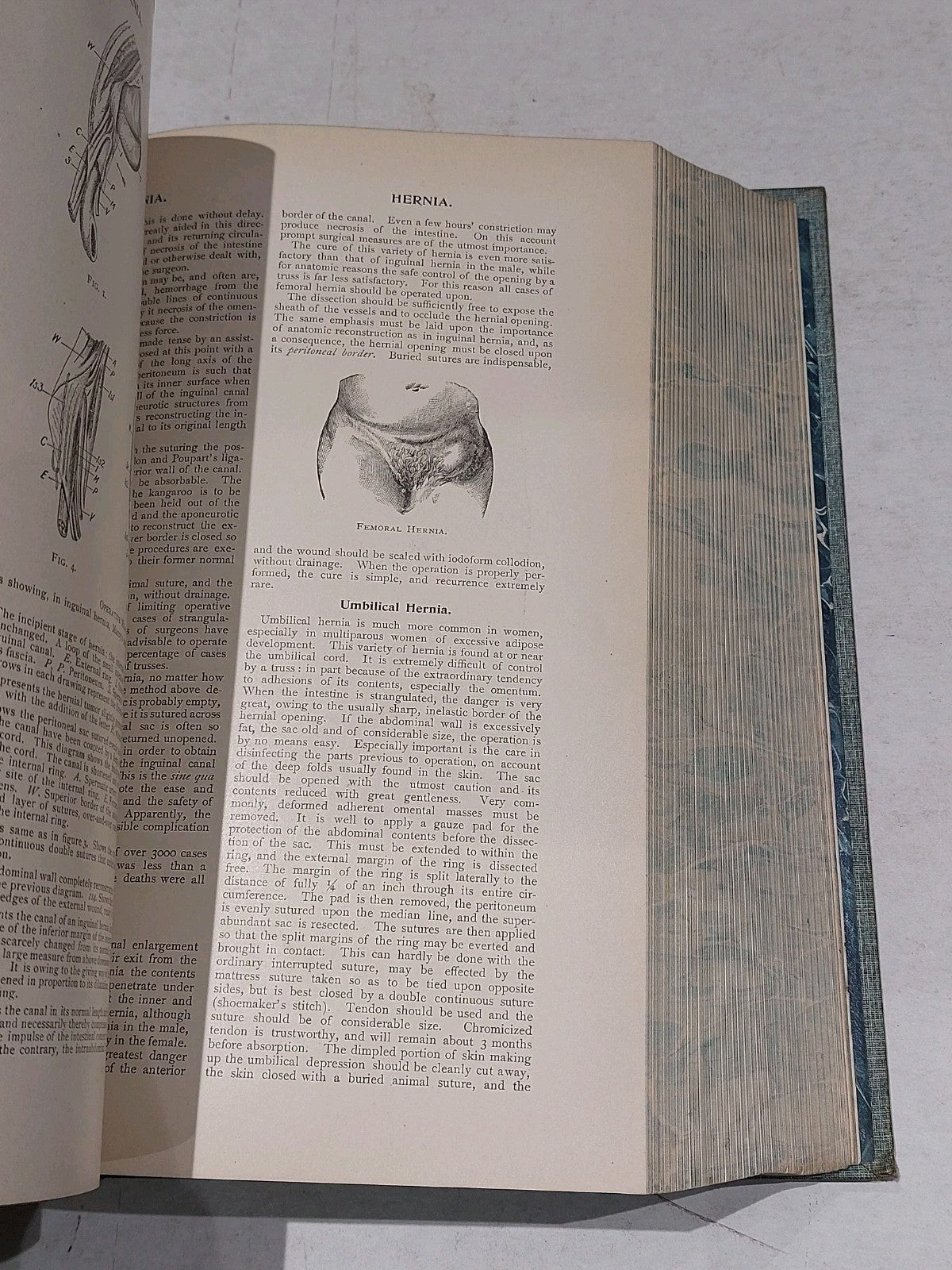 Cyclopedia Of Practical Medicine And Surgery By Gould & Walter (1901) Hb Leather9