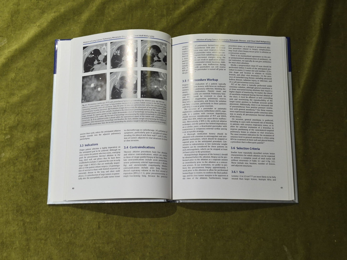 Interventional Oncology (Practical Guides in Interventional Radiology) - Thieme6
