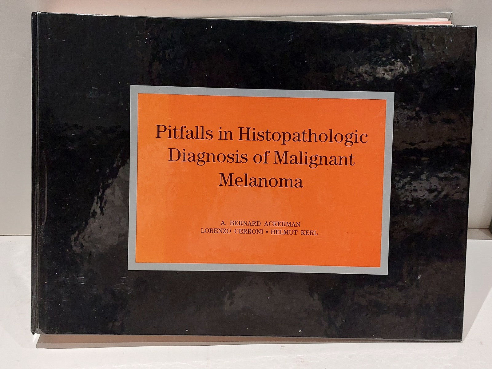 Pitfalls in Histopathologic Diagnosis of Malignant Melanoma by Bernard (1994)0
