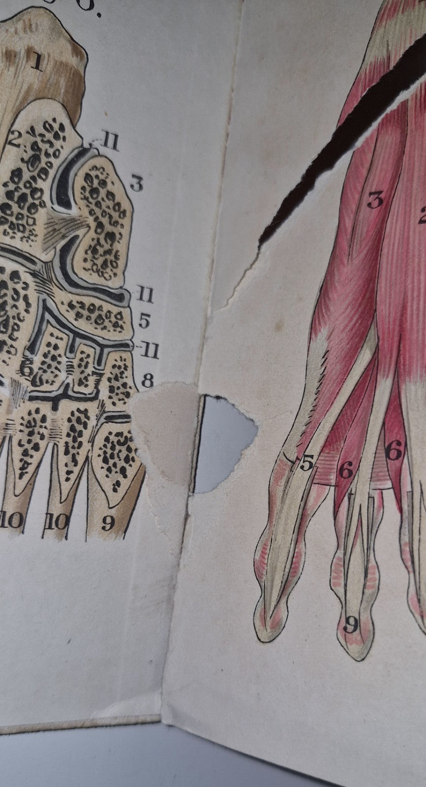 1921 Baillieres Atlas & Anatomy Of The Female Human Body. Swedish Massage Inst.17