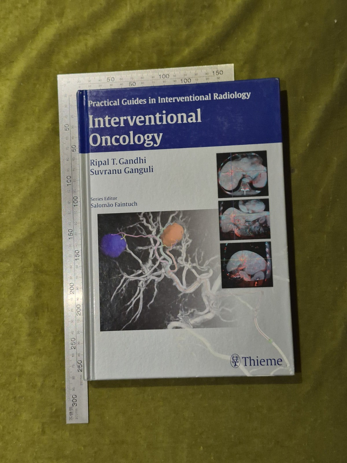 Interventional Oncology (Practical Guides in Interventional Radiology) - Thieme3